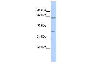 WB Suggested Anti-GBAS Antibody Titration:  0. (GBAS antibody  (Middle Region))