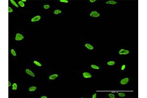 Immunofluorescence of purified MaxPab antibody to PARP1 on HeLa cell. (PARP1 antibody  (AA 1-1014))
