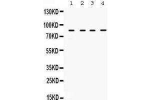 Western Blotting (WB) image for anti-Transforming Growth Factor, beta Receptor II (70/80kDa) (TGFBR2) (AA 96-128), (N-Term) antibody (ABIN3043311)