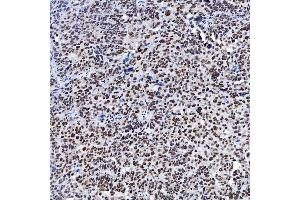 IHC analysis of SF3A1 using anti-SF3A1 antibody (ABIN7600556). (SF3A1 antibody  (AA 20-556))
