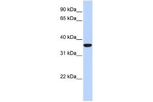 WB Suggested Anti-MAFB Antibody Titration: 0. (MAFB antibody  (N-Term))