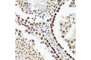 Immunohistochemistry of paraffin-embedded mouse testis using SOX4 antibody (ABIN7270575) at dilution of 1:150 (40x lens). (SOX4 antibody  (AA 1-100))