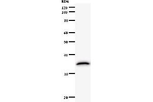Western Blotting (WB) image for anti-Activating Transcription Factor 3 (ATF3) antibody (ABIN5676162) (ATF3 antibody)
