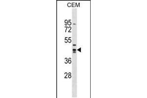 Western blot analysis in CEM cell line lysates (35ug/lane). (Zinc Finger and SCAN Domain Containing 9 (ZSCAN9) (AA 217-243) antibody)