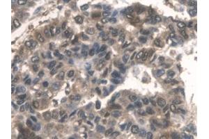 Immunohistochemistry (IHC) image for anti-Aldolase A, Fructose-Bisphosphate (ALDOA) (AA 18-273) antibody (ABIN7440131)