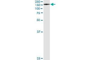 Immunoprecipitation of KIAA1199 transfected lysate using anti-KIAA1199 monoclonal antibody and Protein A Magnetic Bead , and immunoblotted with KIAA1199 MaxPab rabbit polyclonal antibody. (CEMIP antibody  (AA 880-979))