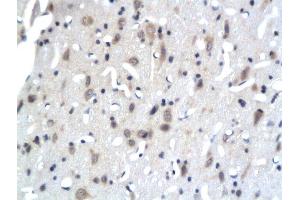 Formalin-fixed and paraffin embedded rat brain tissue labeled with Anti-PKC epsilon Polyclonal Antibody, Unconjugated  followed by conjugation to the secondary antibody (PKC epsilon antibody  (AA 631-737))