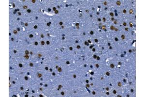 ABIN6263700 and ABIN6266787 at 1/100 staining Rat brain tissue by IHC-P.