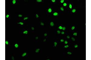 Immunofluorescence staining of U251 cells with ABIN7164153 at 1:166, counter-stained with DAPI. (PRPF39 antibody  (AA 41-190))