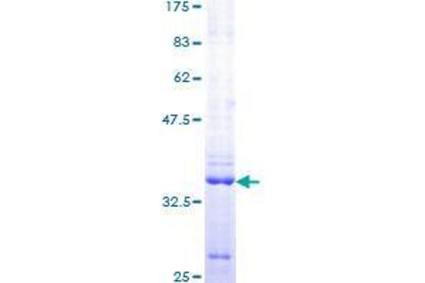 UHRF1 Protein (AA 694-793) (GST tag)