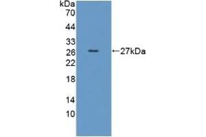 Detection of Recombinant TPMT, Human using Polyclonal Antibody to Thiopurine Methyltransferase (TPMT) (TPMT antibody  (AA 26-227))