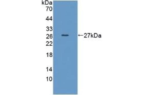 TPMT antibody  (AA 26-227)