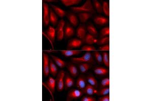 Immunofluorescence analysis of U2OS cells using PSMA5 antibody. (PSMA5 antibody  (AA 1-241))