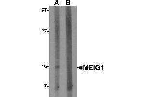 Western blot analysis of MEIG1 in human kidney tissue lysate with MEIG1 antibody at 1 µg/mL in (A) the absence and (B) the presence of blocking peptide. (MEIG1 antibody  (C-Term))