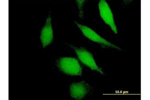 Immunofluorescence of purified MaxPab antibody to DHFR on HeLa cell. (Dihydrofolate Reductase antibody  (AA 1-187))