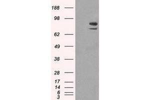 Western Blotting (WB) image for anti-SATB Homeobox 1 (SATB1) antibody (ABIN1500809) (SATB1 antibody)