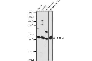 Western blot analysis of extracts of various cell lines, using MED18 antibody (ABIN7268439) at 1:1000 dilution. (MED18 antibody  (AA 30-110))