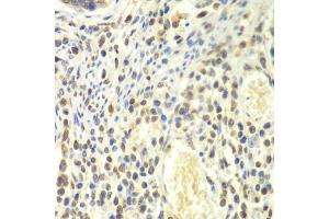 Immunohistochemistry of paraffin-embedded human colon using PSMA4 antibody. (PSMA4 antibody)