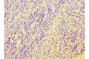 Immunohistochemistry of paraffin-embedded human tonsil tissue using ABIN7171737 at dilution of 1:100 (RAP1 antibody  (AA 1-280))