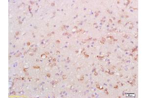 Formalin-fixed and paraffin embedded rat brain labeled with Anti-ATG1/ULK1 Polyclonal Antibody, Unconjugated (ABIN701440) at 1:200 followed by conjugation to the secondary antibody and DAB staining. (ULK1 antibody  (AA 951-1050))