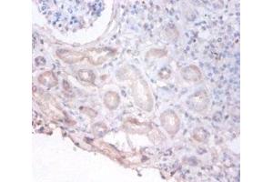 Immunohistochemistry of paraffin-embedded human kidney tissue using ABIN7149438 at dilution of 1:100 (PHGDH antibody  (AA 2-251))