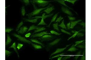 Immunofluorescence of monoclonal antibody to CDK9 on HeLa cell. (CDK9 antibody  (AA 271-372))