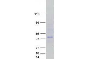 Western Blotting (WB) image for Fas Apoptotic Inhibitory Molecule 2 (FAIM2) protein (Myc-DYKDDDDK Tag) (ABIN2720709)