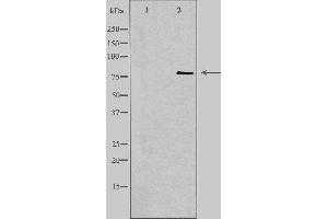 Western blot analysis of extracts from COLO cells, using CNKR1 antibody. (CNKSR1 antibody  (Internal Region))