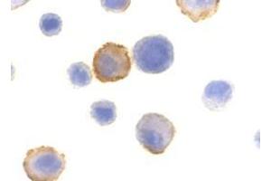 Immunocytochemistry of Bmf in HeLa cells with AP30157PU-N Bmf antibody at 10 μg/ml. (BMF antibody  (N-Term))