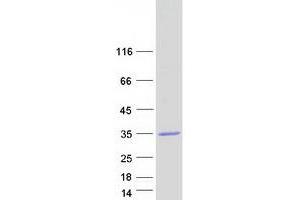 ABHD17B Protein (Transcript Variant 1) (Myc-DYKDDDDK Tag)