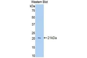 Western blot analysis of the recombinant protein. (GAS6 antibody  (AA 356-511))