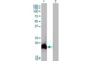 Western Blot analysis of AHNAK expression in transfected 293T cell line by AHNAK monoclonal antibody (M01), clone 3G7.