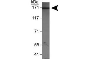 Western blot analysis of WHSC1L1 (isoform 1) in HeLa nuclear extracts with WHSC1L1 polyclonal antibody . (WHSC1L1 antibody  (AA 300-400))