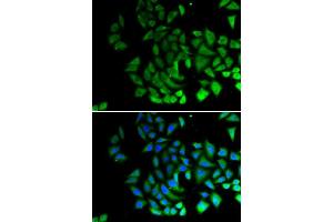 Immunofluorescence (IF) image for anti-Piwi-Like 1 (PIWIL1) antibody (ABIN6219364) (PIWIL1 antibody)