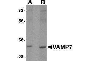 Western blot analysis of VAMP7 in mouse lung tissue lysate with VAMP7 antibody at 1 µg/mL. (VAMP7 antibody)