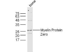 Bone lysates probed with Myelin Protein Zero Polyclonal Antibody, Unconjugated  at 1:300 dilution and 4˚C overnight incubation. (MPZ antibody  (AA 175-248))