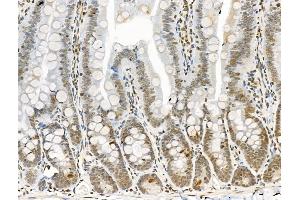 ABIN6256314 and ABIN6267147 at 1/100 staining Rat colorectal tissue by IHC-P. (NUMA1 antibody  (pSer395))