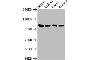 Western Blot Positive WB detected in: Rat heart tissue, Rat kidney tissue, Mouse heart tisseu, Mouse kidney tissue All lanes: ITGA6 antibody at 3 μg/mL Secondary Goat polyclonal to rabbit IgG at 1/50000 dilution Predicted band size: 127, 120, 123, 122, 125, 107 kDa Observed band size: 100 kDa (ITGA6 antibody  (AA 625-866))