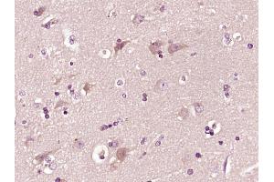 anti-C1q and Tumor Necrosis Factor Related Protein 2 (C1QTNF2) (AA 101-200) antibody