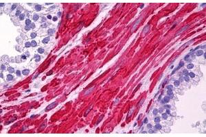 LDLRAP1 antibody  (AA 1-264)