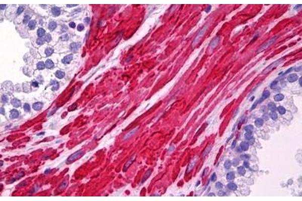 LDLRAP1 antibody  (AA 1-264)