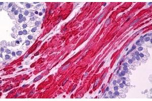 Anti-LDLRAP1 antibody IHC staining of human prostate, smooth muscle. (LDLRAP1 antibody  (AA 1-264))