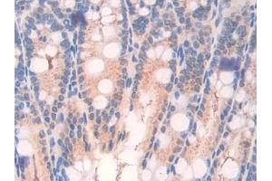 Detection of ATF7 in Mouse Intestine Tissue using Polyclonal Antibody to Activating Transcription Factor 7 (ATF7) (ATF7 antibody  (AA 50-270))