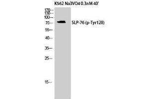 Western Blotting (WB) image for anti-Lymphocyte Cytosolic Protein 2 (SH2 Domain Containing Leukocyte Protein of 76kDa) (LCP2) (pTyr128) antibody (ABIN3179707) (LCP2 antibody  (pTyr128))
