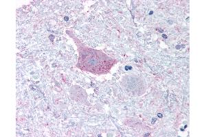 Anti-MRGPRD antibody IHC of human brain, medulla. (MRGPRD antibody  (Cytoplasmic Domain))
