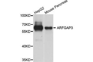 Western blot analysis of extract of HepG2 and mouse pancreas cells, using ARFGAP3 antibody. (ARFGAP3 antibody)