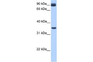 Western Blotting (WB) image for anti-Potassium Inwardly-Rectifying Channel, Subfamily J, Member 5 (KCNJ5) antibody (ABIN2458042) (KCNJ5 antibody)