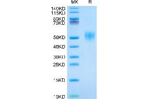 Human Fc gamma RIIIB (NA1) on Tris-Bis PAGE under reduced condition. (FCGR3B Protein (AA 17-200) (His tag))