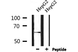 Western blot analysis of extracts from HepG2, using GPR153 Antibody. (GPR153 antibody  (Internal Region))