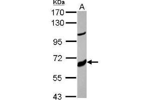 WB Image Sample (30 ug of whole cell lysate) A: MCF-7 7. (CYP17A1 antibody  (Center))